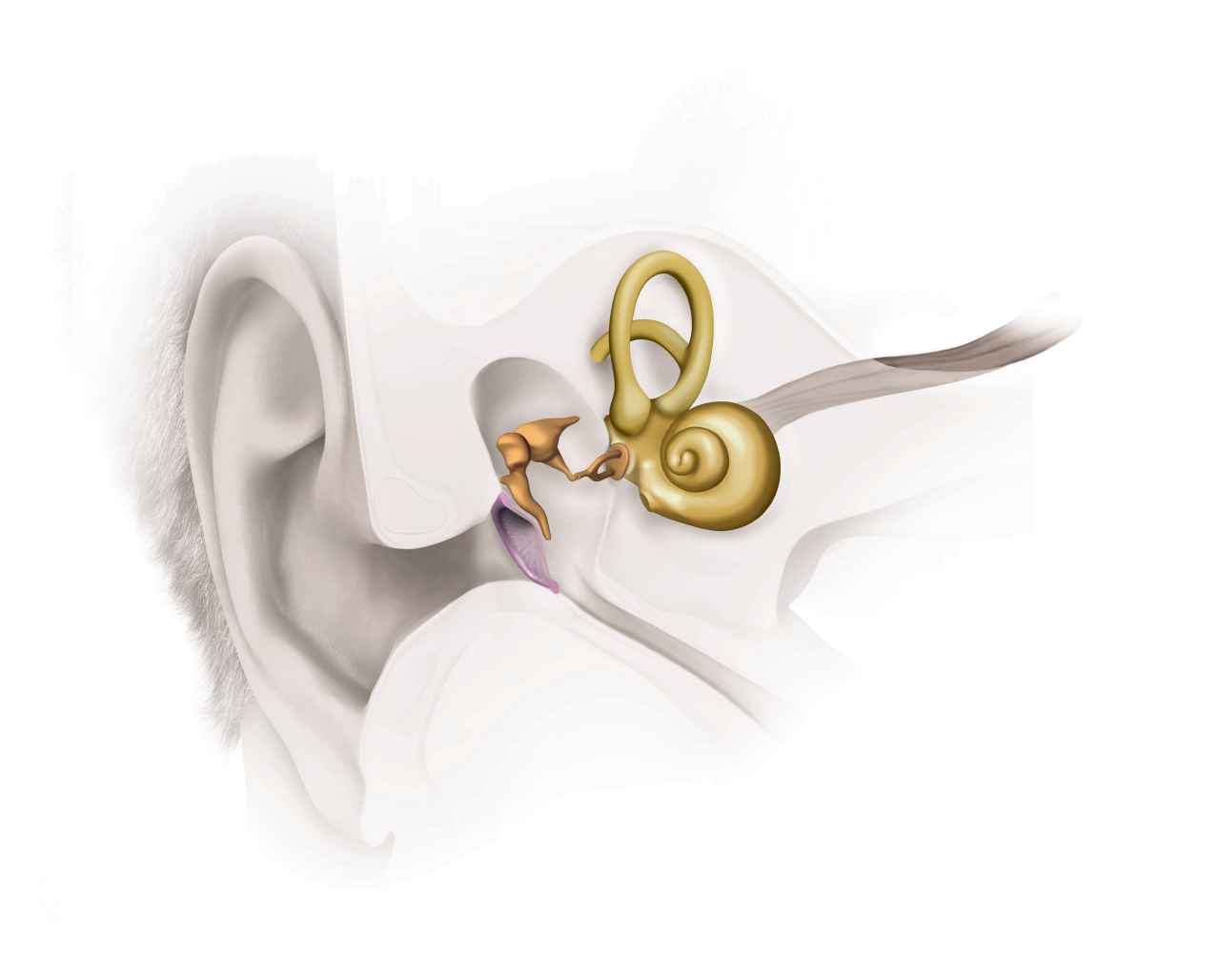 Kombinierte_Schwerhörigkeit_2_EarAnatomy_Mixed HL