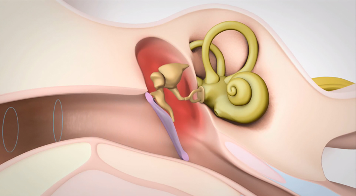 hearing_loss_conductive-1