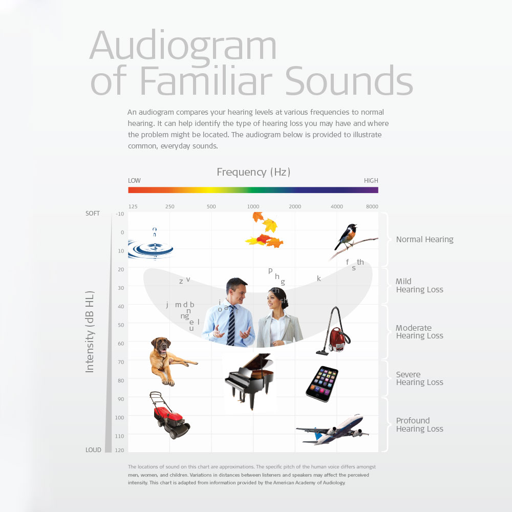 audiogram-4