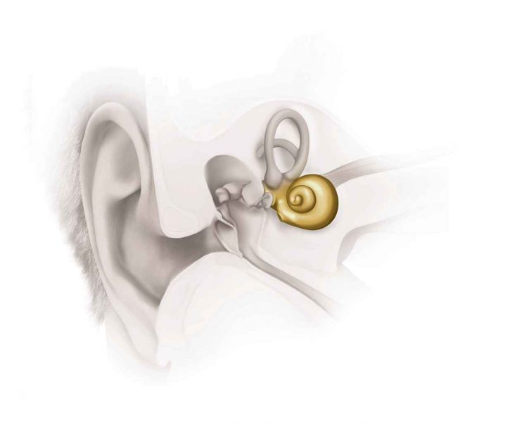 Schallempfindungsschwerhoerigkeit_2_EarAnatomy_Sensorineural-HL-1